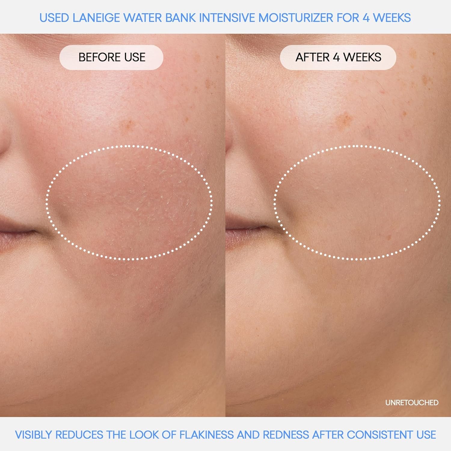 Revitalize Your Skin with Water Bank Blue Hyaluronic Intensive Moisturizer - Ultimate Hydration Cream for Extra Dry Skin Featuring Squalane & Peptides for Enhanced Skin Barrier Support